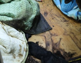 옆집에 거주하고 있던 독거노인이 고독사를 하여 시신부패 악취가 건물 전체에 발생하고 있는 상황인데 이에 대한 문제해결 방안이 있는지 당사에 연락이 옴


당사에 연락한 사람은 해당 고독사현장의 이웃주민인데 고인은 유가족이 전혀 없는 무연고사망자인 관계로 현재 현장에 대한 책임을 지는 사람이 나타나지 않아 변사체 혈액, 부패액, 인체조직 등의 오염물이 장기간 방치되어 있는 중이라고 함


이 때문에 시신부패 악취가 건물 전체에 퍼져 입주민들이 난리가 난 상황이며 본인이 거주하고 있는 집안에도 시신부패 악취로 인하여 사람이 들어갈 수 없는 지경까지 놓이자 온 가족이 여행용 가방에 생필품을 챙긴채 회사, 친척집, 친구집, 모텔 등을 전전하며 지낸다고 함


이웃주민은 이대로 가만히 있을 수만은 없다고 판단하여 행정복지센터는 물론 시청, 도청까지 전부 연락하여 고독사현장의 문제해결이 가능한지 물어보았는데 지자체에서 돌아오는 답변은 “본인들이 도와줄 수 있는 방법은 전혀 없다.”였다고 함


이에 다른 방안을 강구하던 이웃주민은 당사에 연락하여 어떻게 좀 도움을 받을 수 있는지 재차 물어본 것이었고 당사는 한국유품정리사협회에서 고인이 사망한 위치에 존재하는 변사체 혈액, 부패액 등의 오염제거 및 위생처리 자원봉사를 지원하고는 있는데 이는 지자체의 요청과 허가가 있어야지만 협회 회원사들이 집안으로 진입할 수 있기에 다시 지자체에 연락하여 해당 서비스를 신청해달라고 얘기함


고인이 사망한 위치에 존재하는 변사체 오염물이라도 제거해 놓으면 시신부패 악취로 인한 피해를 어느 정도 해소할 수 있고 그렇다면 입주민들도 집안에서 최소한의 거주는 가능하기에 이웃주민은 곧바로 그렇게 하겠다며 통화를 종료하였지만 몇 주가 지난 현재까지도 한국유품정리사협회에 자원봉사 요청은 접수되지 않았음


이를 미루어 보아 고독사현장에 대한 이웃주민과 지자체의 소통이 원활하지 않은 것으로 판단됨


&nbsp;
&nbsp;
* 주요 문제
고독사한 이웃주민이 무연고사망자인 관계로 고독사현장에 대한 책임을 지는 사람이 전혀 없어 시신부패악취로 인한 피해가 건물 전체에 발생하는 상황이며 이에 일부 입주민들은 집을 나가 다른 곳에서 생활하는 상황
&nbsp;
&nbsp;
&nbsp;
&nbsp;